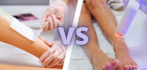 Laser Hair Removal vs Other Hair Removal